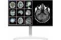 LG Clinical Review LED Monitor 27HJ712C-W 27 tum 14 ms Silver DICOM 60
